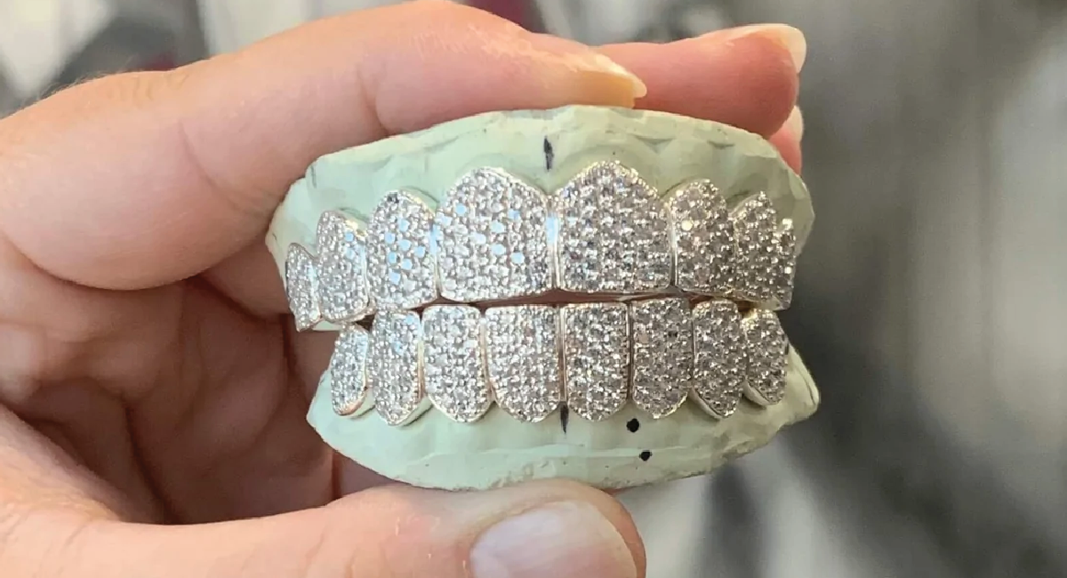 Gold’s Contribution to Pricing of Diamond Grillz