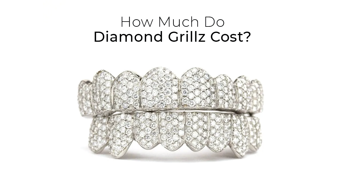 How much do diamond grillz cost?