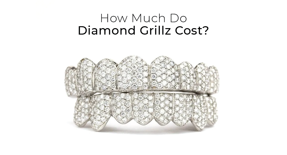 How Much Are Diamond Grillz? - RRP