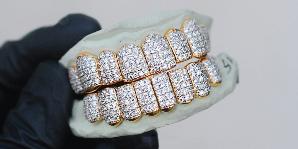 How much do diamond grillz cost?